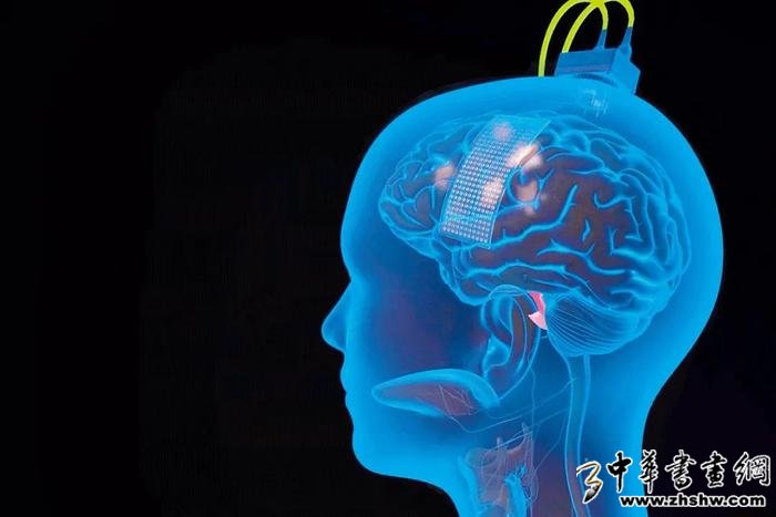 安的大脑表面植入了一个薄薄的矩形电极，以接收其试图说话时发出的信号。图/加州大学